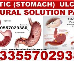 Natural Solution for Stomach Ulcer in Ghana Accra Kumasi Tamale