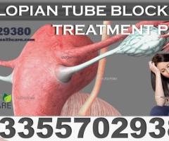 NATURAL SOLUTION FOR  BLOCKED FALLOPIAN TUBES IN GHANA - Image 2