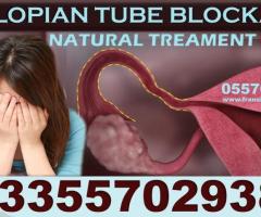 NATURAL SOLUTION FOR  BLOCKED FALLOPIAN TUBES IN GHANA - Image 3