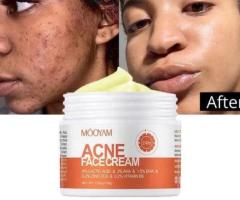Pimples, Acne Face Cream - Image 1